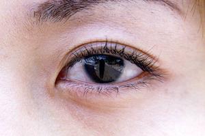 心斎橋で二重整形を受けるならば