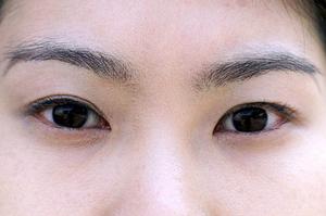 脂肪吸引の効果と安全性を徹底解説!最適なクリニック選びのポイント